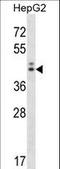 Neuroguidin antibody, LS-C164861, Lifespan Biosciences, Western Blot image 