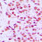 ETS Proto-Oncogene 1, Transcription Factor antibody, LS-C352174, Lifespan Biosciences, Immunohistochemistry paraffin image 