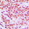 Histone H2B antibody, LS-C353496, Lifespan Biosciences, Immunohistochemistry frozen image 