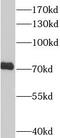 Rac GTPase-activating protein 1 antibody, FNab07071, FineTest, Western Blot image 