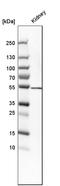 Serine hydroxymethyltransferase, cytosolic antibody, HPA023314, Atlas Antibodies, Western Blot image 