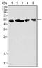 Keratin, type II cytoskeletal 8 antibody, AM06284SU-N, Origene, Western Blot image 