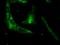 Ubiquitin B antibody, BML-PW1210-0025, Enzo Life Sciences, Immunofluorescence image 