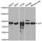 Junction Plakoglobin antibody, orb48937, Biorbyt, Western Blot image 