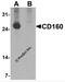 CD160 antigen antibody, 7475, ProSci, Western Blot image 