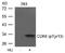 Cyclin Dependent Kinase 6 antibody, AP09488PU-S, Origene, Western Blot image 