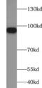 Solute Carrier Family 4 Member 1 (Diego Blood Group) antibody, FNab00798, FineTest, Western Blot image 