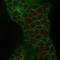 Tumor Associated Calcium Signal Transducer 2 antibody, NBP2-75746, Novus Biologicals, Immunofluorescence image 