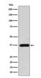 FBP antibody, M01377-1, Boster Biological Technology, Western Blot image 