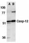 Caspase-12 antibody, AHP626, Bio-Rad (formerly AbD Serotec) , Western Blot image 