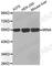 Ribosomal Oxygenase 2 antibody, A2334, ABclonal Technology, Western Blot image 