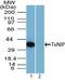 Thioredoxin Interacting Protein antibody, TA337136, Origene, Western Blot image 