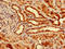 Solute Carrier Family 25 Member 1 antibody, LS-C671288, Lifespan Biosciences, Immunohistochemistry paraffin image 
