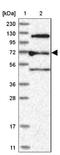 Rho GTPase Activating Protein 28 antibody, NBP1-84640, Novus Biologicals, Western Blot image 