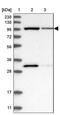 Exocyst complex component 2 antibody, PA5-56923, Invitrogen Antibodies, Western Blot image 