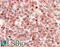 Histone-lysine N-methyltransferase MLL2 antibody, 45-890, ProSci, Immunohistochemistry paraffin image 