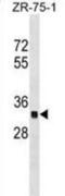 Olfactory Receptor Family 2 Subfamily C Member 3 antibody, abx029815, Abbexa, Western Blot image 