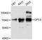 Glypican 4 antibody, STJ114671, St John