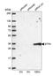 Electron transfer flavoprotein subunit alpha, mitochondrial antibody, HPA024089, Atlas Antibodies, Western Blot image 