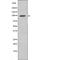 Fibroblast Growth Factor Receptor 3 antibody, PA5-64581, Invitrogen Antibodies, Western Blot image 
