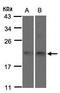 Sorting Nexin 12 antibody, GTX106456, GeneTex, Western Blot image 