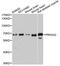 Protein Kinase AMP-Activated Catalytic Subunit Alpha 2 antibody, A7339, ABclonal Technology, Western Blot image 