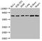 Rho GTPase Activating Protein 18 antibody, CSB-PA850791LA01HU, Cusabio, Western Blot image 