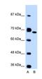 Fibronectin 1 antibody, orb330187, Biorbyt, Western Blot image 