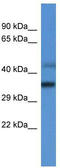 Mitochondrial Ribosomal Protein L45 antibody, TA342963, Origene, Western Blot image 