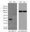 Alcohol dehydrogenase [NADP+] antibody, GTX84912, GeneTex, Western Blot image 
