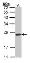 Suppressor Of Cytokine Signaling 1 antibody, GTX100657, GeneTex, Western Blot image 
