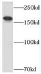 Ubiquitin Specific Peptidase 32 antibody, FNab09324, FineTest, Western Blot image 