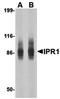 SP110 Nuclear Body Protein antibody, orb74918, Biorbyt, Western Blot image 