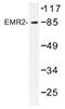 Adhesion G Protein-Coupled Receptor E2 antibody, AP01298PU-N, Origene, Western Blot image 