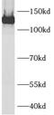 AXL Receptor Tyrosine Kinase antibody, FNab00754, FineTest, Western Blot image 