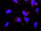 Coagulation Factor XII antibody, H00002161-M01, Novus Biologicals, Proximity Ligation Assay image 