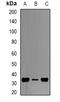 Had antibody, orb340728, Biorbyt, Western Blot image 