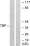 TATA-Box Binding Protein antibody, LS-C118815, Lifespan Biosciences, Western Blot image 