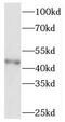 Sterol O-acyltransferase 2 antibody, FNab08098, FineTest, Western Blot image 