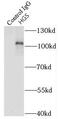 Hepatocyte Growth Factor-Regulated Tyrosine Kinase Substrate antibody, FNab03853, FineTest, Immunoprecipitation image 