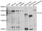Alsin Rho Guanine Nucleotide Exchange Factor ALS2 antibody, A02991, Boster Biological Technology, Western Blot image 