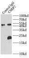 Cysteine And Glycine Rich Protein 2 antibody, FNab02030, FineTest, Immunoprecipitation image 