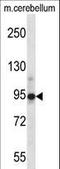 Chordin antibody, LS-C168748, Lifespan Biosciences, Western Blot image 