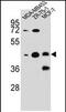 Kelch Repeat And BTB Domain Containing 13 antibody, PA5-71638, Invitrogen Antibodies, Western Blot image 