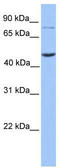 Zinc Finger And BTB Domain Containing 6 antibody, TA343627, Origene, Western Blot image 