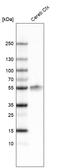 LIM/homeobox protein Lhx2 antibody, AMAb91404, Atlas Antibodies, Western Blot image 
