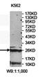 Ectodysplasin-A receptor-associated adapter protein antibody, orb78250, Biorbyt, Western Blot image 