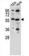 Cysteine sulfinic acid decarboxylase antibody, AP51094PU-N, Origene, Western Blot image 