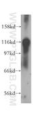 RAS P21 Protein Activator 1 antibody, 12935-1-AP, Proteintech Group, Western Blot image 