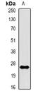 Rac Family Small GTPase 1 antibody, abx142070, Abbexa, Western Blot image 